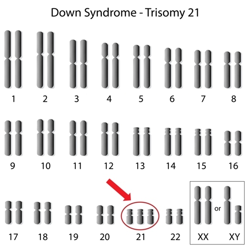 Polkörperdiagnostik für Chromosom 21